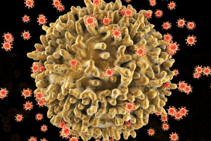 The surface of the T-cell has a lumpy appearance with large irregular surface protrusions. Smaller spherical structures on the cell surface are HIV virus particles budding away from the cell membrane. The virus has infected the T-cell, and instructed the cell to reproduce many more viruses.